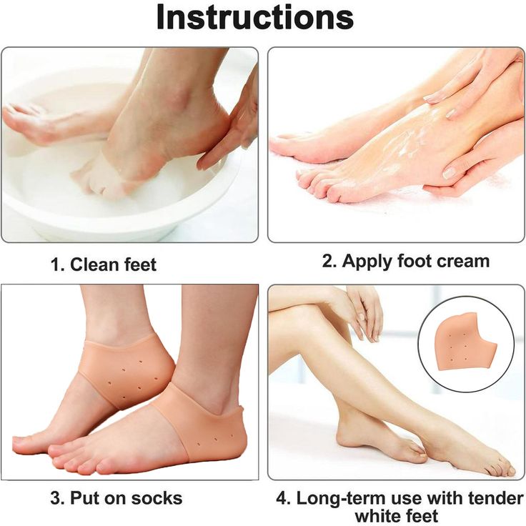 Silicone Heel Protectors - heel protector in use