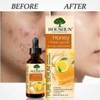 Roushun Lemon Serum - bottle detail